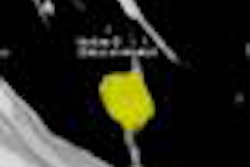 2013 01 31 15 24 24 564 Vliegenthart middle 20130131222940