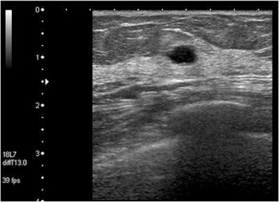 CAD increased mean confidence level