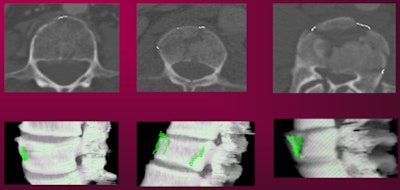 2013 02 06 11 41 42 172 Burns Slide17 450