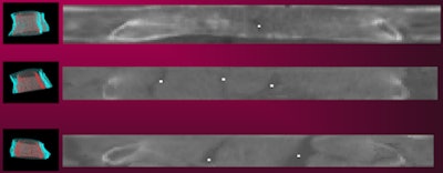 2013 02 06 11 41 44 853 Burns Slide11 450