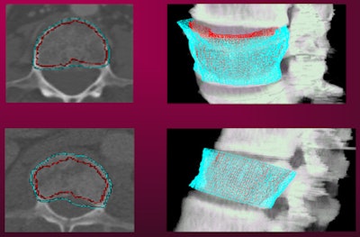 2013 02 06 11 41 45 892 Burns Slide9 450