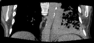 2013 02 07 16 38 50 474 Coronal Mcd3 450