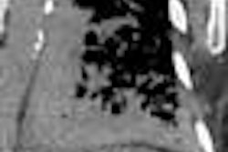 2013 02 07 16 38 50 474 Coronal Mcd3 450 20130208213107