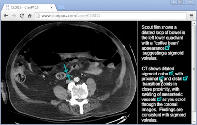ClariPACS interactive radiology report