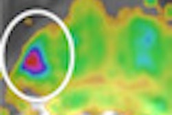 2013 03 05 16 37 28 726 2013 03 08 Prostate Mri Thumb