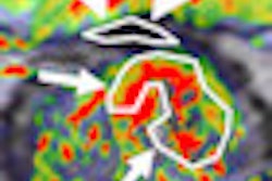 2013 03 06 13 03 52 101 2013 03 08 Cancer Thumb