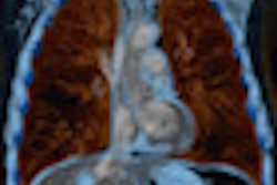 2013 03 06 14 21 24 103 2013 03 08 Ct Thumb