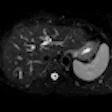 2013 03 07 10 22 40 150 2013 03 07 Colorectal Thumb