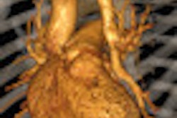 2013 03 07 16 30 11 223 2013 03 09 Congenital Thumb