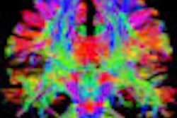 2013 03 07 17 33 42 799 2013 03 09 Mri Thumb