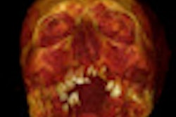 2013 03 09 13 18 05 971 5 B Carotid Disease 70