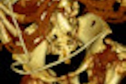 2013 03 09 15 23 39 509 2013 03 11 Urogen Thumb