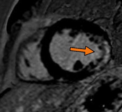 2013 03 20 14 15 33 881 Scar 400