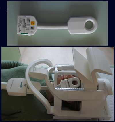 Dwi Mri Assists Proton Beam Therapy For Ocular Melanoma Auntminnie