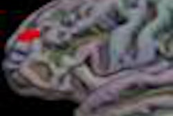 2013 03 27 09 15 23 25 Migraine Figure1 400 20130327162156