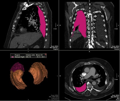 2013 03 27 09 59 32 238 Volumetry2 400