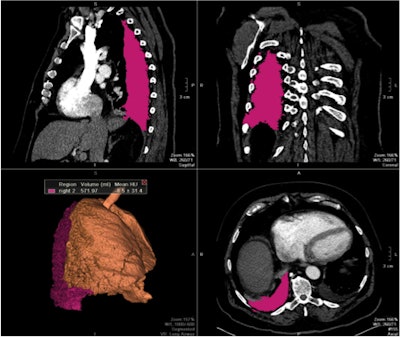 2013 03 27 09 59 34 159 Volumetry1 400