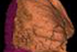 2013 03 27 09 59 34 159 Volumetry1 400 20130327170224