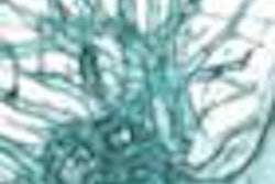 2013 03 29 09 18 43 967 Ding stenosis preop Top 450 20130329201305