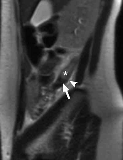 2013 04 01 14 53 03 968 Rapp Fig2a 400