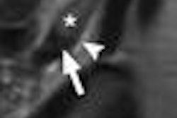 2013 04 01 14 53 03 968 Rapp Fig2a 400 20130401215739