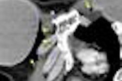 2013 04 02 13 52 18 883 Periimplant Gas Ct 400 20130402205530