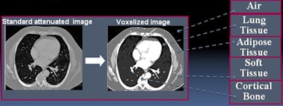 Each voxel in the voxelized datasets was assigned a specific material type based on International Commission on Radiation Units and Measurements Report 44.