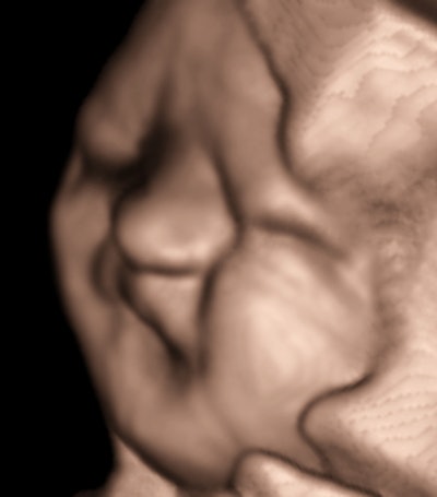 2013 04 12 14 59 09 248 2013 04 15 Birnholz4