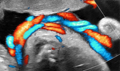 2013 04 12 14 59 13 981 2013 04 15 Birnholz1