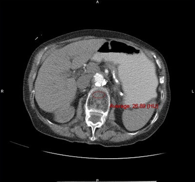 2013 04 15 14 58 18 952 2013 04 16 Pickhardt2