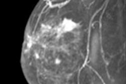 2013 04 24 15 00 32 840 Mango Mri 18 450 20130424220503