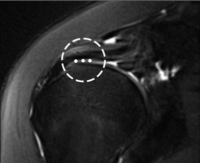 Width was measured from its medial to lateral margins (circle).