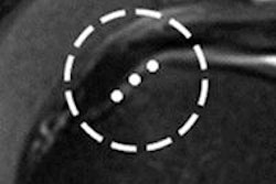 2013 04 29 13 01 48 496 Gryft Fig A 400 20130429200516