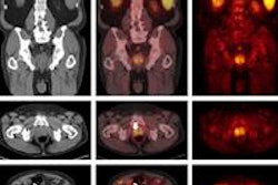 2013 05 03 15 31 02 732 C 11 Acetate Pet Ct Images 450 20130503223333