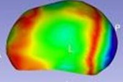 2013 05 20 13 45 27 40 Cad Skull 450 20130520205102