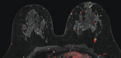 MRI with CAD