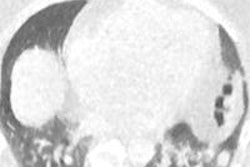 2013 06 20 09 52 02 30 Kazerooni Blotchy Pixelated 400 20130620165919