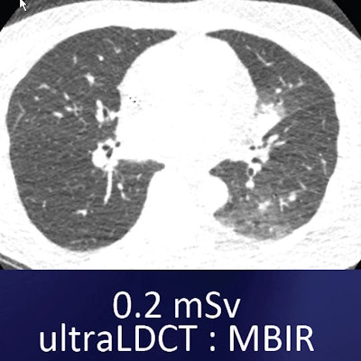 2013 06 20 09 52 04 317 Kazerooni uldct Mbir1 Bottom 400