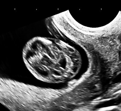 All images courtesy of Dr. Jason Birnholz.