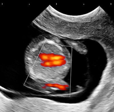 2013 06 25 14 34 00 254 Birnholztri18hrt 450