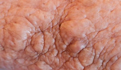 2013 06 25 14 34 01 98 Birnholzlskin 450