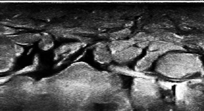 2013 06 25 14 34 02 172 Birnholzledema 450