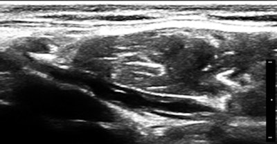 2013 06 25 14 34 04 651 Birnholzfig7 450