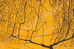 2013 06 27 14 36 21 376 Neuron No3 200