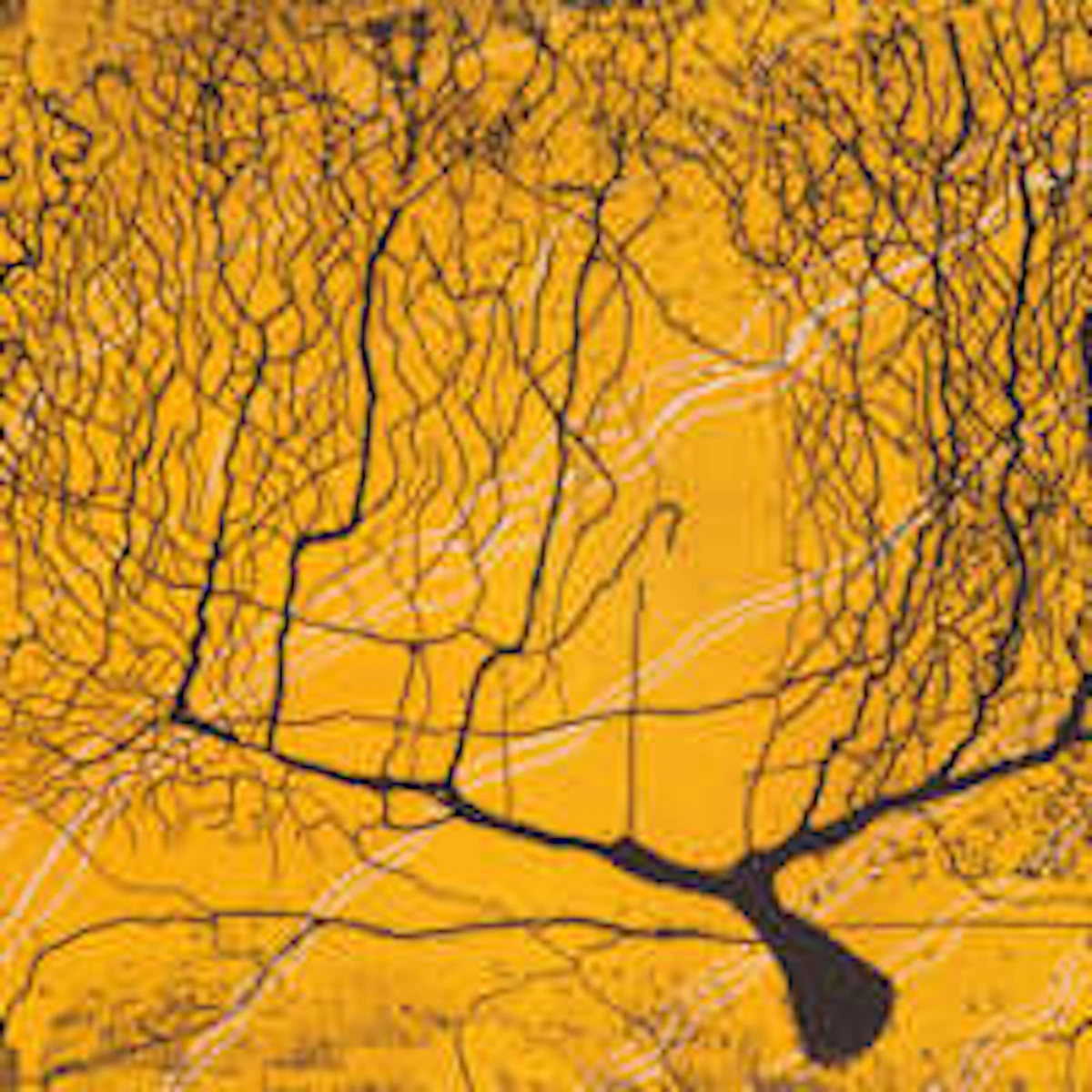 絵画 『ミレニアム』 NORRY Stanford neuroimaging center highlights MRI-based artwork | AuntMinnie