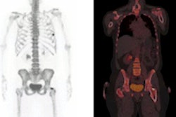 2013 06 28 15 33 27 935 Petct 200