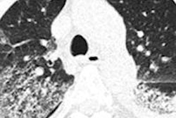 2013 07 01 16 04 56 680 Wang Radiology 450 20130701230959