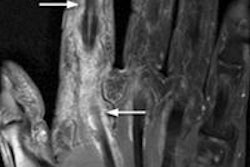 2013 07 08 14 57 48 578 Gado Dose Mri Rad Schueller 450 20130708220100