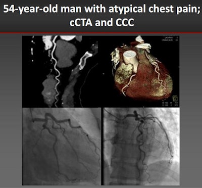 CCTA shows clear arteries