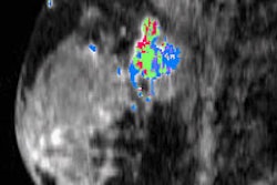 2013 08 02 09 37 57 659 2013 08 09 Dce Mri Radiology 200